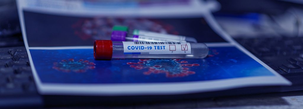NEWS | Secondary school and college students to get weekly rapid COVID-19 tests from January