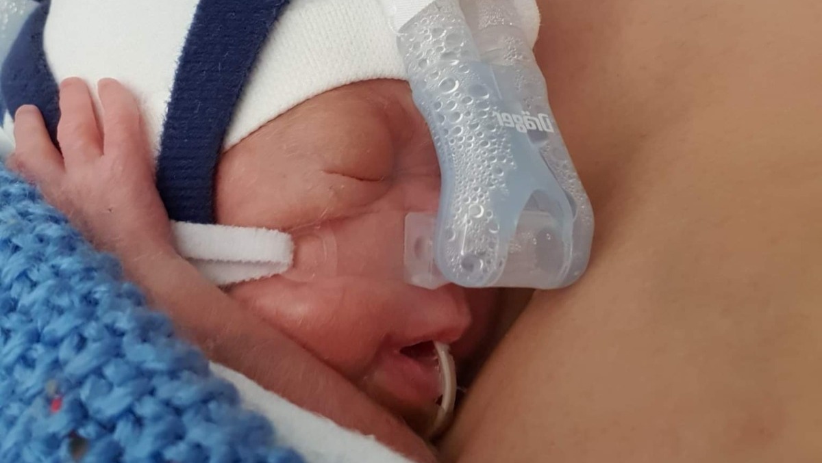 NEWS | Fundraising page set up to support the family of Pace who was born weighing just 642 grams