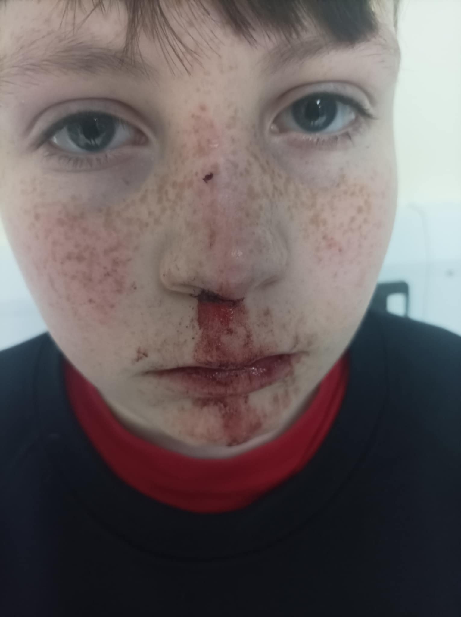 NEWS | Hereford mum pleads with Herefordshire Council to grit pavements after her son was injured